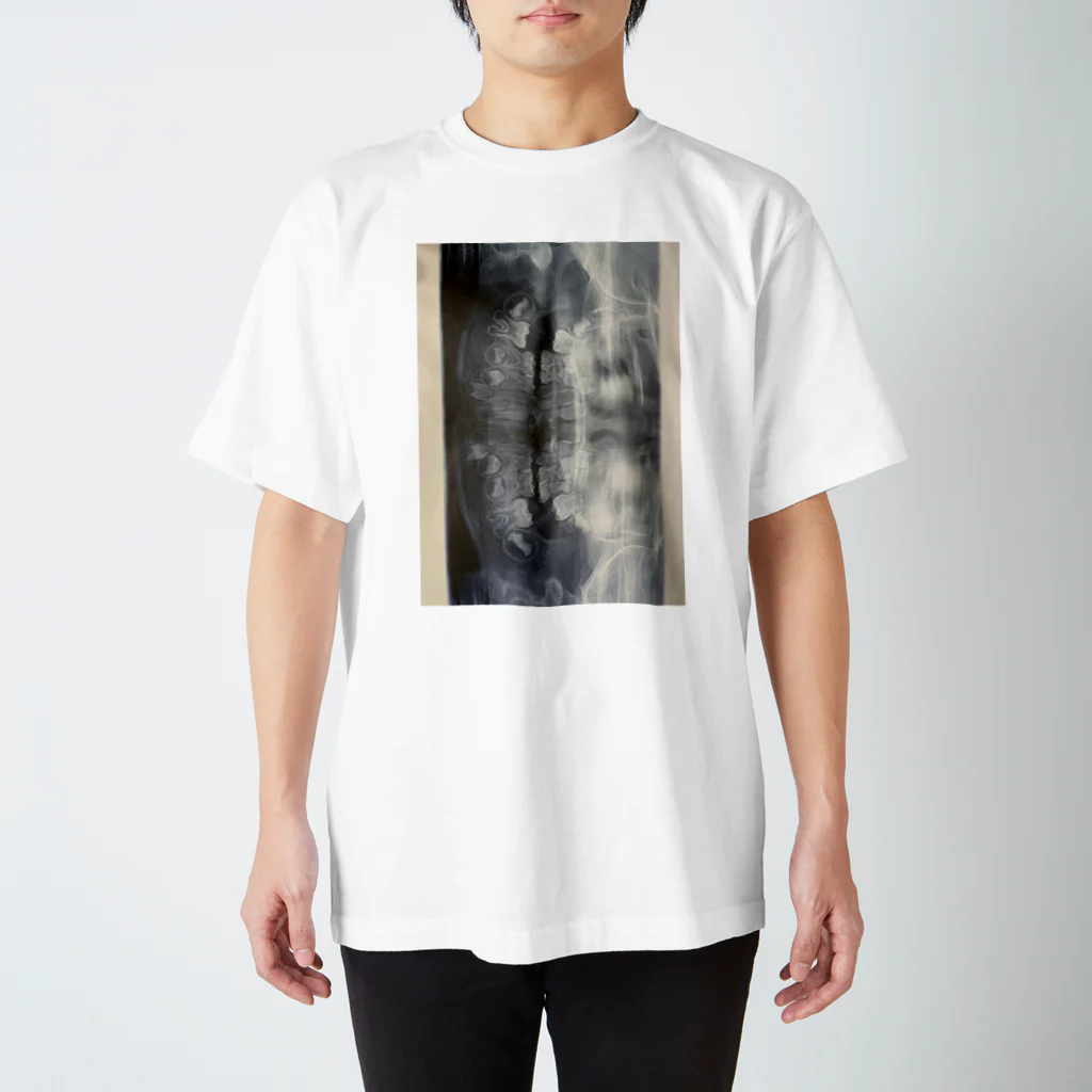 atata_fashionのX線歯茎 Regular Fit T-Shirt