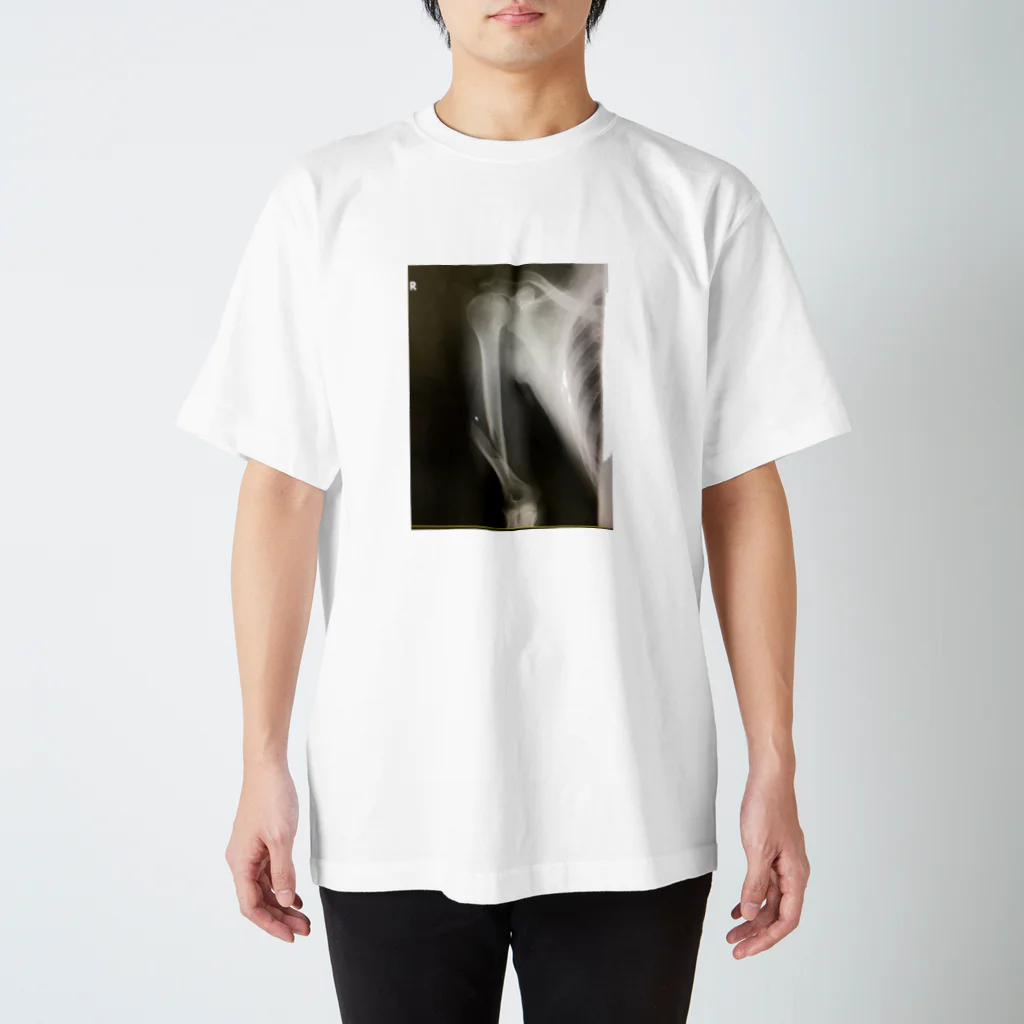 yu_mixの骨折レントゲン Regular Fit T-Shirt