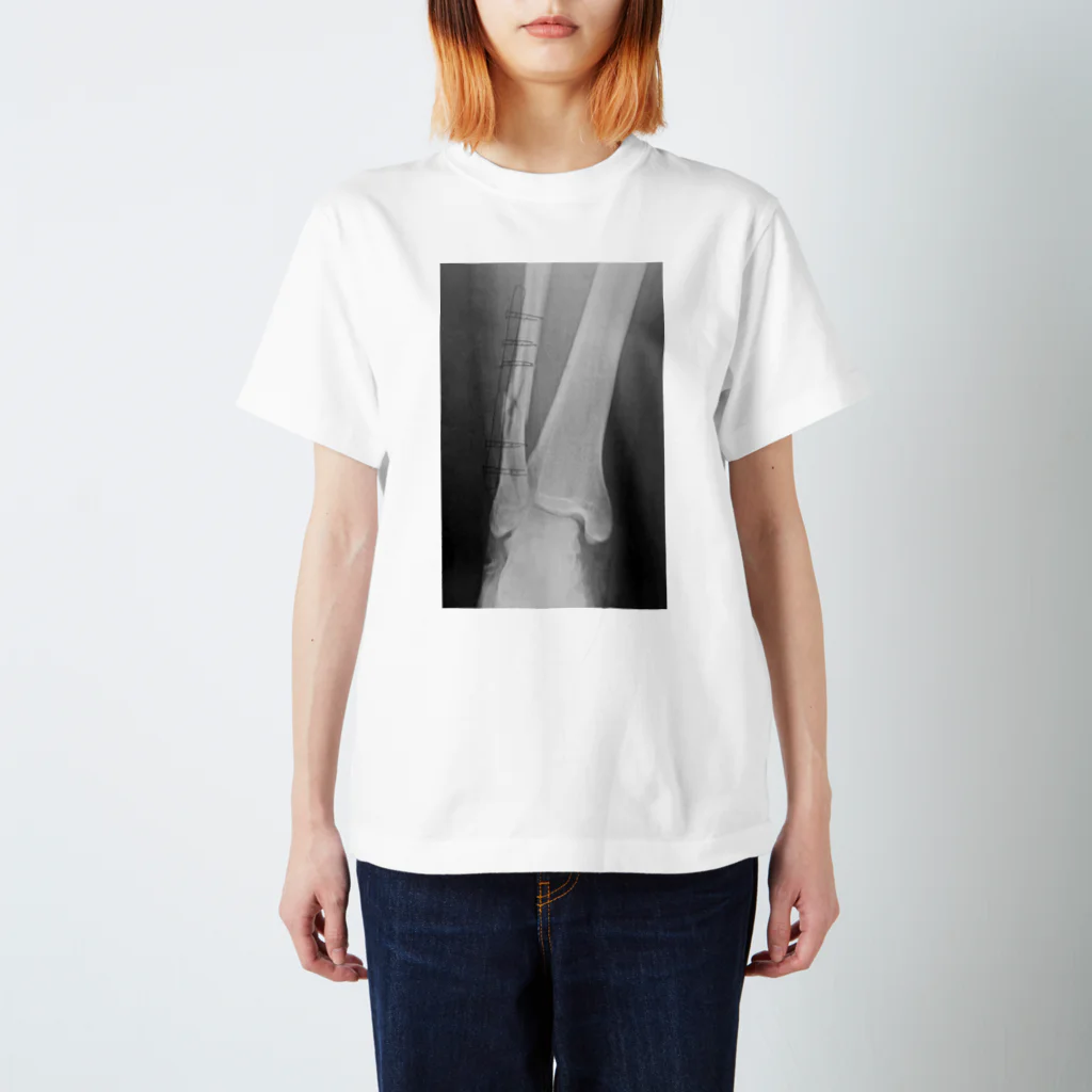 しゃったーみゅーじあむのBroken Leg スタンダードTシャツ