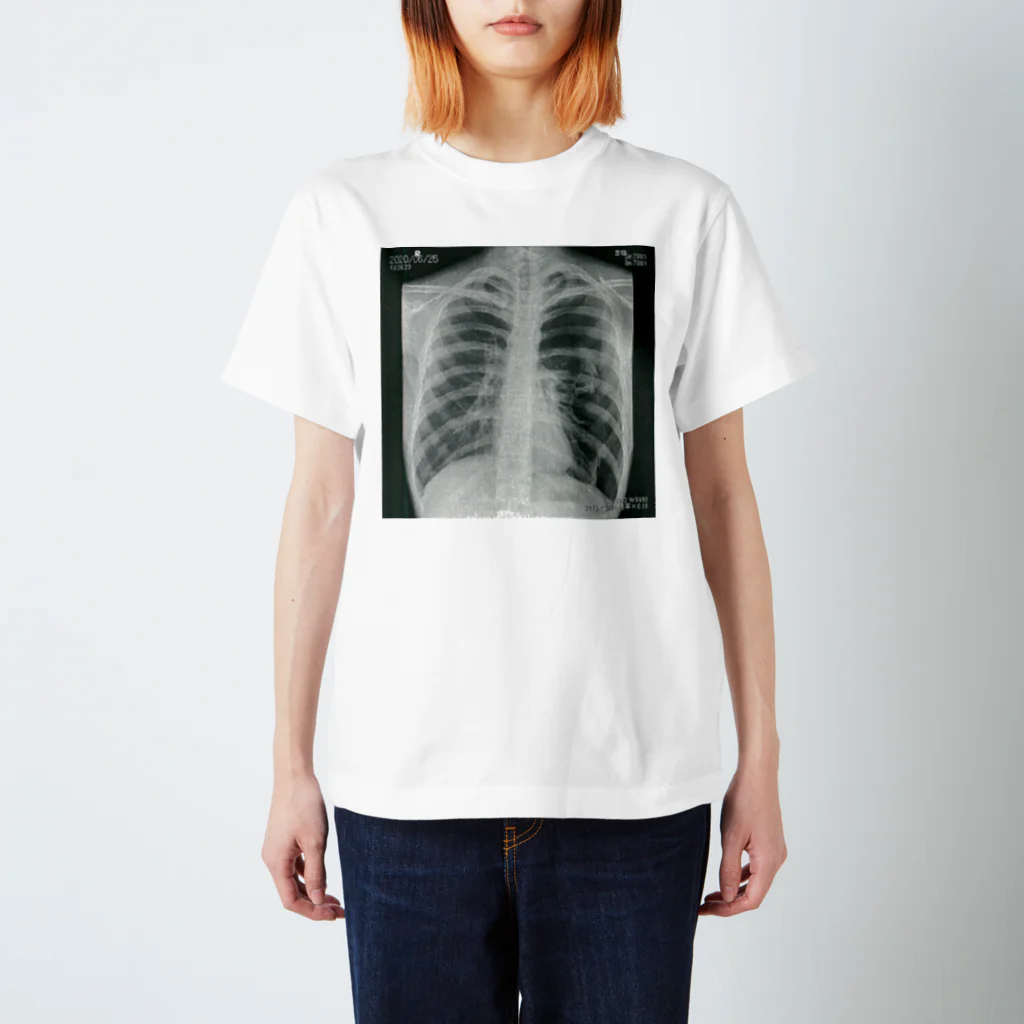 mztnの肺気胸のレントゲン写真 Regular Fit T-Shirt