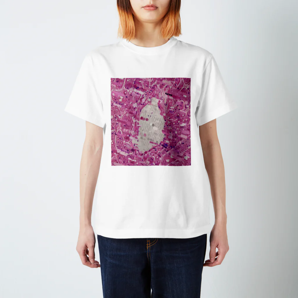 SHCm.のPathology1 スタンダードTシャツ