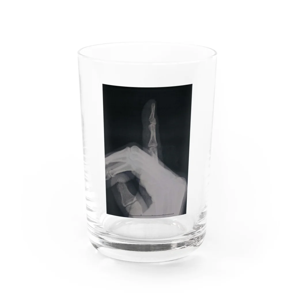 チームすけころの骨折 fracture  Water Glass :front