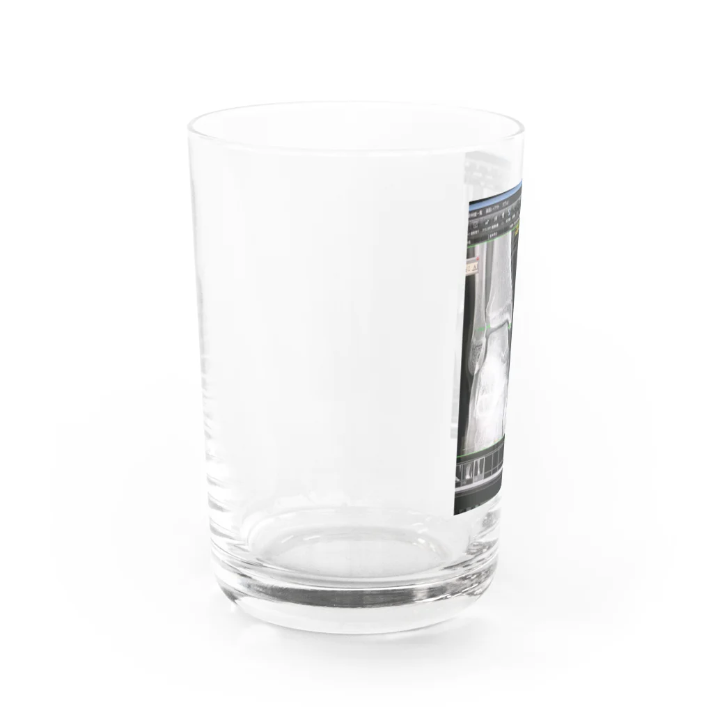 asano shouのちゃんと靭帯怪我してします。 Water Glass :left