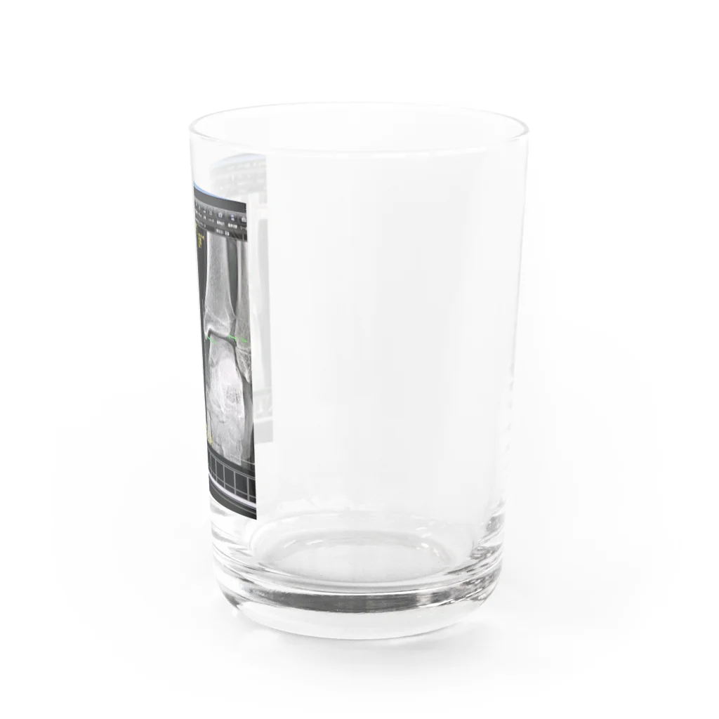 asano shouのちゃんと靭帯怪我してします。 Water Glass :right