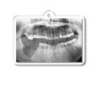 きちの歯と歯茎摘出レントゲン Acrylic Key Chain