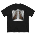 Smoking is addictiveのSmoking is addictive ビッグシルエットTシャツ