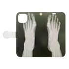 mijinko_jinkoのbreak a leg  Book-Style Smartphone Case:Opened (outside)