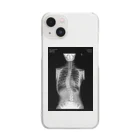 ハ息子の背骨レントゲン Clear Smartphone Case