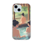 DH＋の江戸時代温泉地での湯治客 Clear Smartphone Case