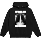 ポンこつの私のレントゲン（身体） Hoodie