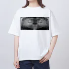 little MAKES.のX-ray of teeth(歯のレントゲン) オーバーサイズTシャツ