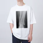 しゃったーみゅーじあむのBroken Leg オーバーサイズTシャツ