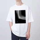 Deadfoolの骨折T Oversized T-Shirt