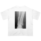 しゃったーみゅーじあむのBroken Leg オーバーサイズTシャツ