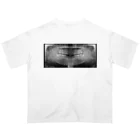 little MAKES.のX-ray of teeth(歯のレントゲン) オーバーサイズTシャツ