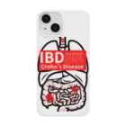 大逆天 Daigyakuten-onlineのクローン病患者が作るIBDシリーズ Smartphone Case