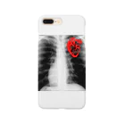 FabergeのX-ray Smartphone Case