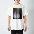 こじろうさんのレントゲン Regular Fit T-Shirt