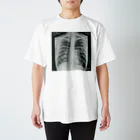 mztnの肺気胸のレントゲン写真 Regular Fit T-Shirt