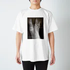 彩羽真矢のらくがきショップの【期間限定復活】骨折エンターテイメント2 Regular Fit T-Shirt