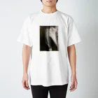 yu_mixの骨折レントゲン Regular Fit T-Shirt