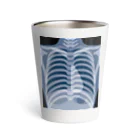 kimchinのレントゲン Thermo Tumbler