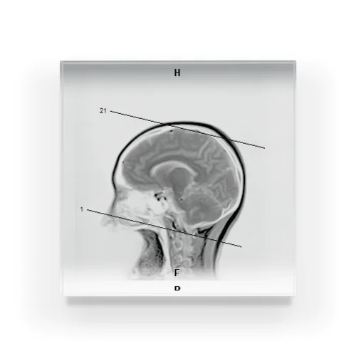 私の脳グッズ（改） アクリルブロック