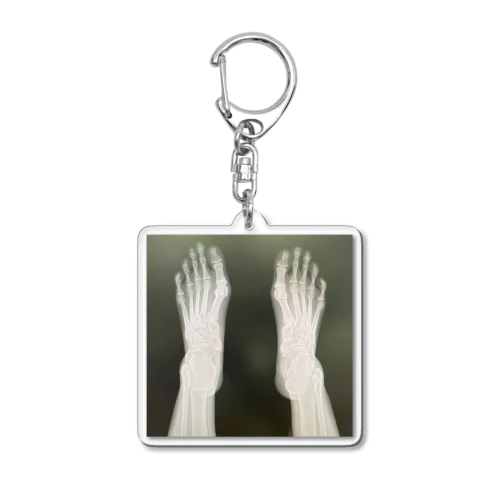 break a leg  Acrylic Key Chain