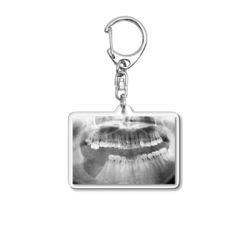 歯と歯茎摘出レントゲン Acrylic Key Chain