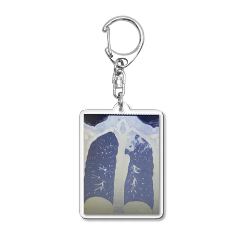 俺の肺 Acrylic Key Chain