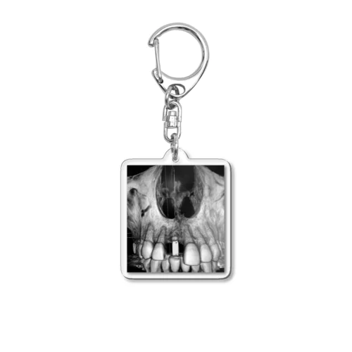 THE implant Acrylic Key Chain