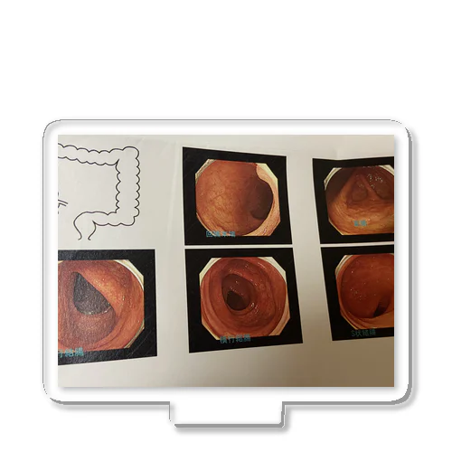 私の綺麗な大腸 アクリルスタンド
