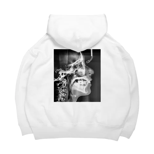 好きな子の横顔レントゲン Big Hoodie