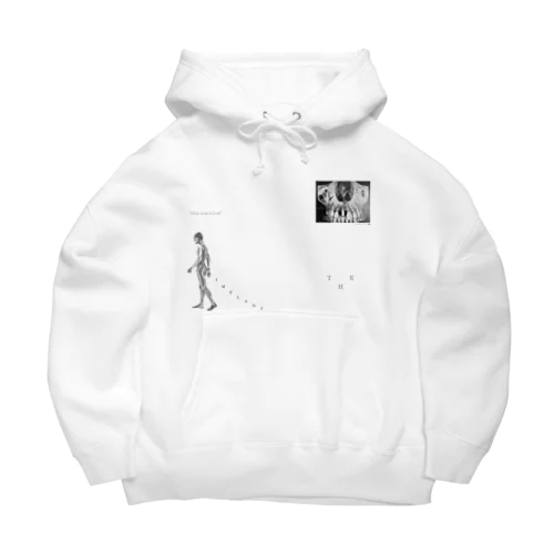 THE implant2 Big Hoodie