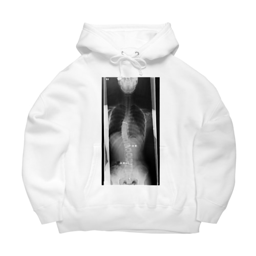をに＠ぐんそーの背骨ヌード　無印 Big Hoodie