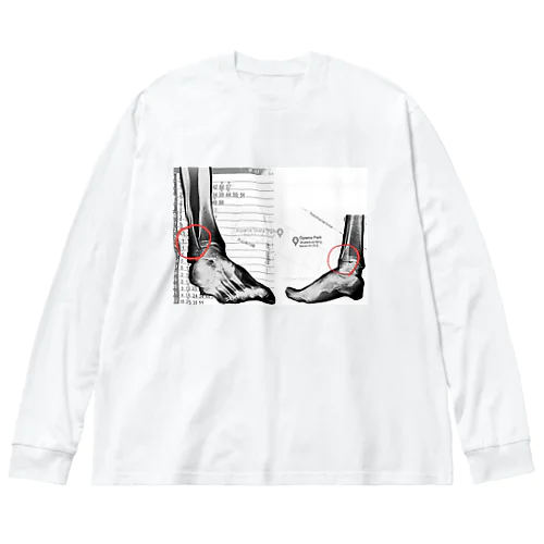 骨折したワシのレントゲン Big Long Sleeve T-Shirt