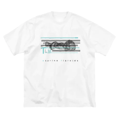 子宮筋腫TシャツB（術式入り） Big T-Shirt