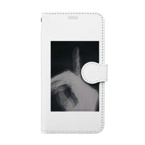 骨折 fracture  Book-Style Smartphone Case