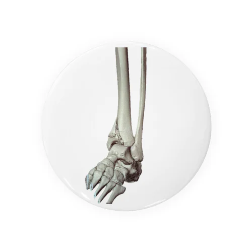 左脛骨遠位端骨折CT画像（くり抜き） 缶バッジ