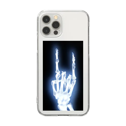 レントゲン風　🤘🏻 Clear Smartphone Case