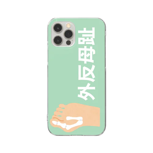 外反母趾 Clear Smartphone Case