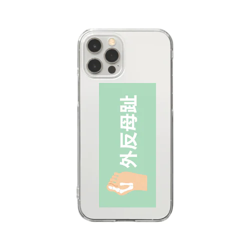 外反母趾 Clear Smartphone Case