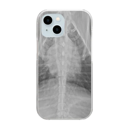 ティアラの胸部 Clear Smartphone Case
