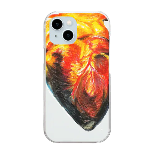 発作性上室性頻脈 Clear Smartphone Case