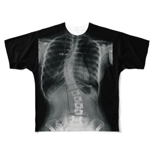 背骨レントゲン（フロントプリント） 풀그래픽 티셔츠