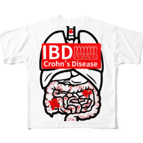 クローン病患者が作るIBDシリーズ フルグラフィックTシャツ