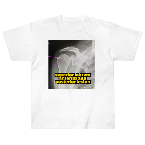 Slap Heavyweight T-Shirt