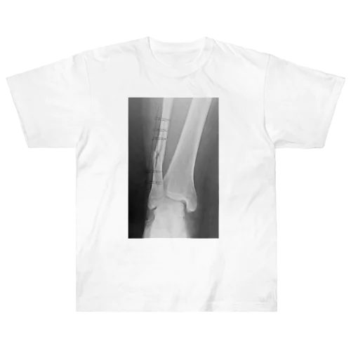 Broken Leg Heavyweight T-Shirt
