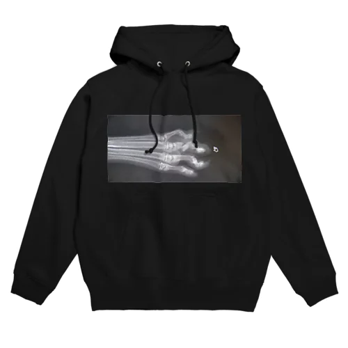 骨折レントゲン写真 Hoodie