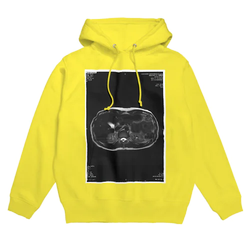 輪切りの俺 Hoodie